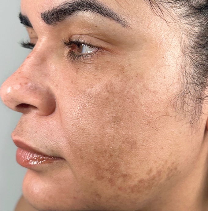 imagem de antes e depois