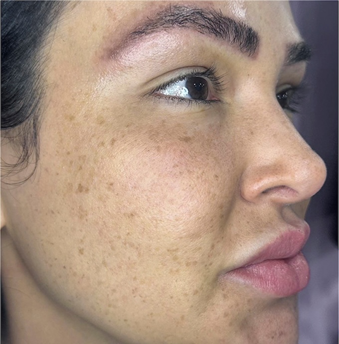 imagem de antes e depois
