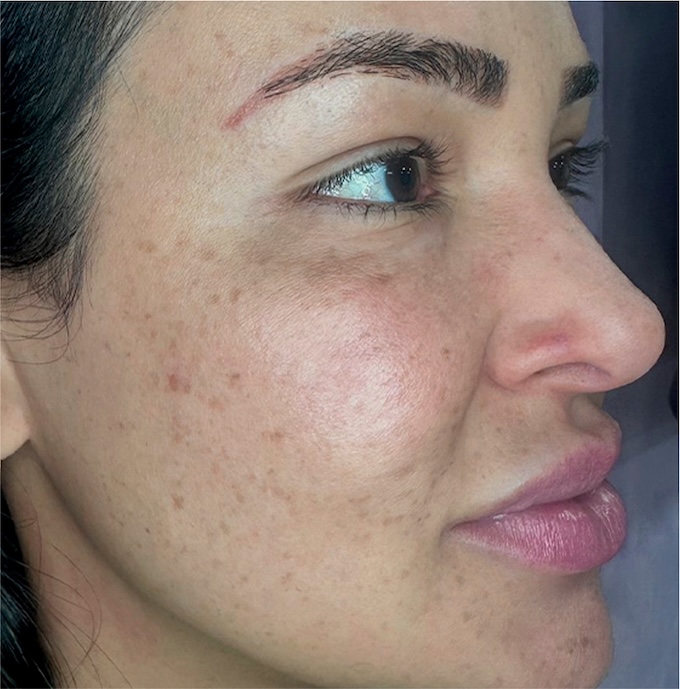 imagem de antes e depois
